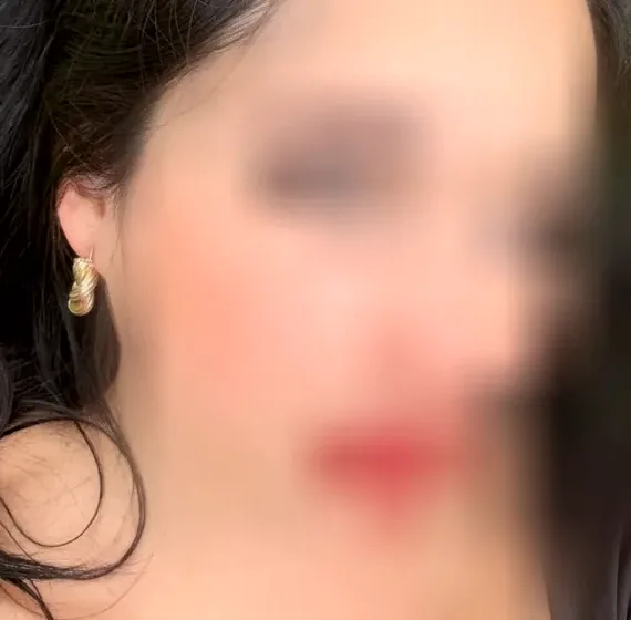 Molly, 37